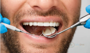 Oral Hygiene