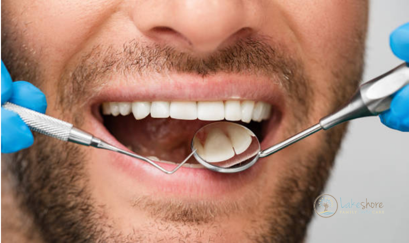 Oral Hygiene