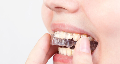 Bite-Guard-Therapy_img
