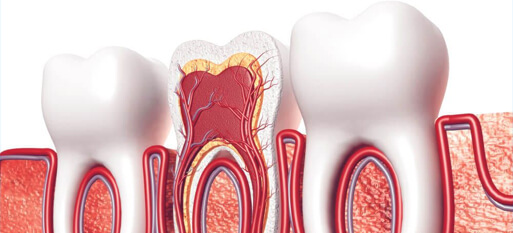 Root-Canals_img