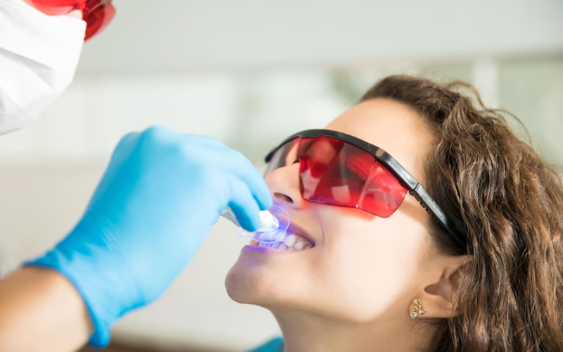 Teeth whitening