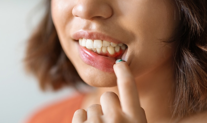 what is the fastest way to cure gingivitis