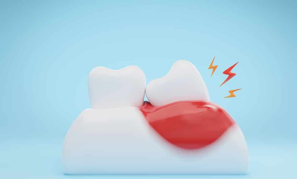 healthy diet for optimal oral health