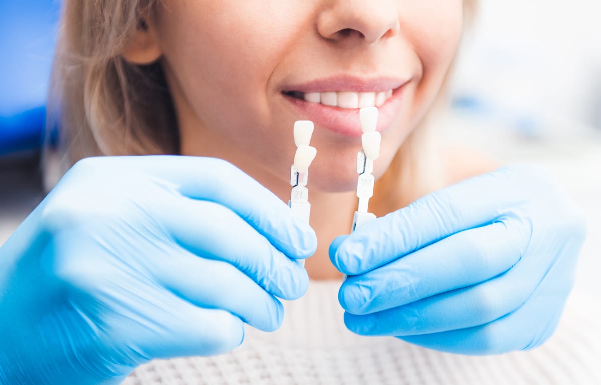 Why Your Veneers Won&#    ;t Look Like Fake Teeth