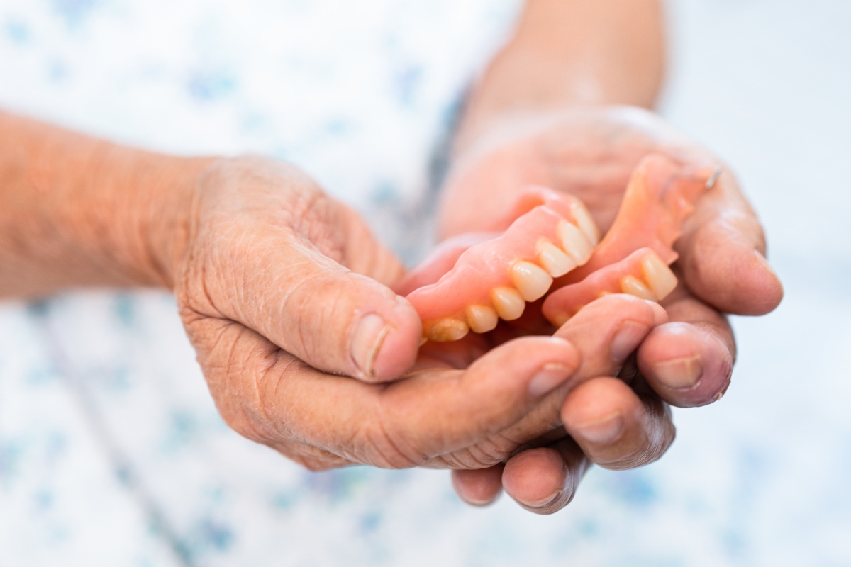 Full-Arch-Dentures