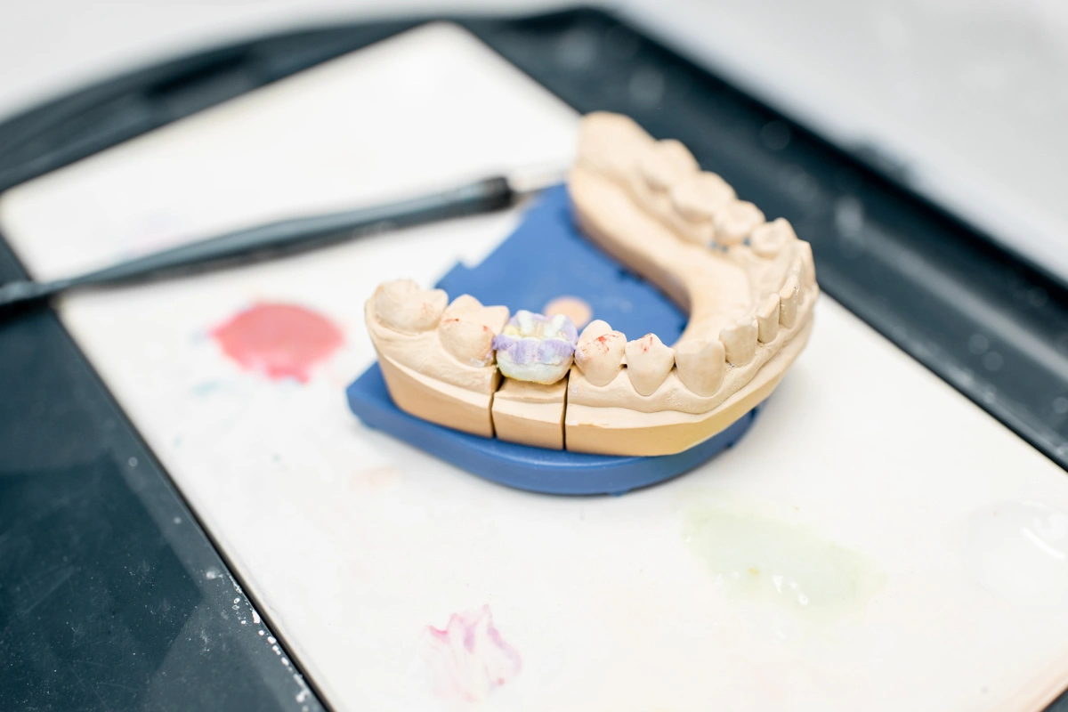 Preventing Enamel Erosion with Luxe Dental Arts | Dentist in 77479