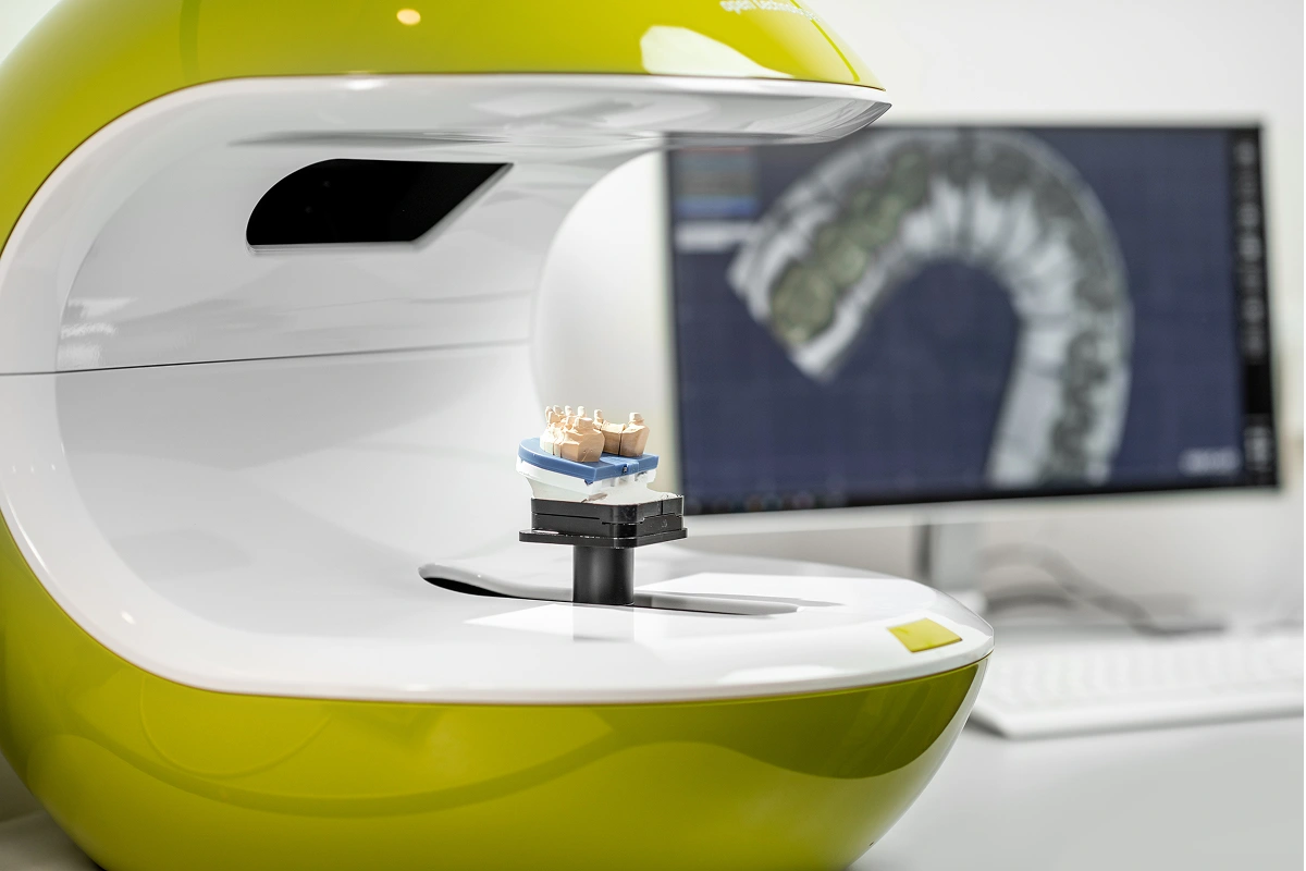 Digital Impressions: A Comfortable and Accurate Approach to Modern Dentistry
