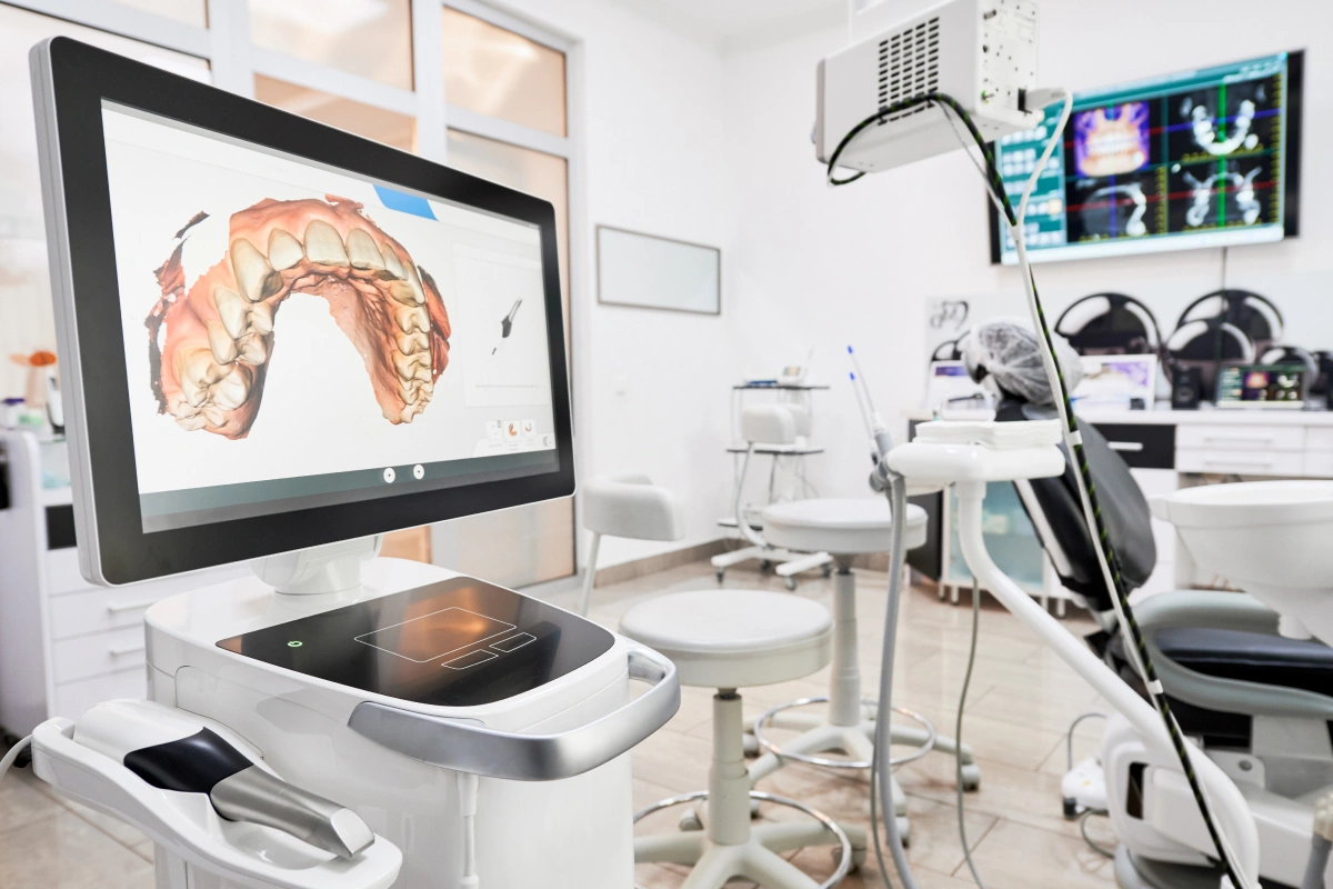 Digital Impressions: A Comfortable and Accurate Alternative to Traditional Molds