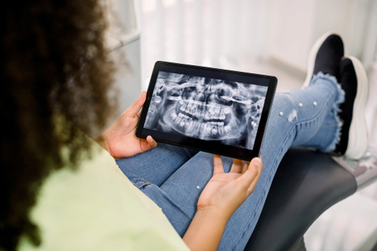 Discover the Advantages of Digital Impressions in Dentistry