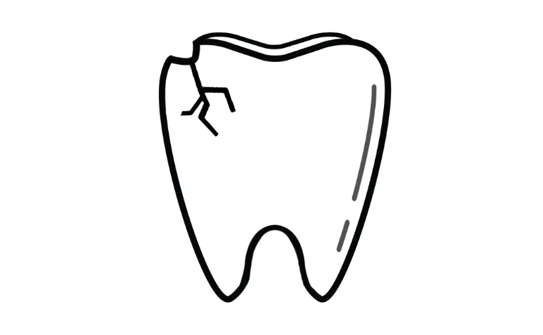 I Chipped a Tooth! What Can I Do? | Dentist Near Me
