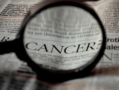 Oral Cancer Screening Can Save Your Life | Family Dentist in Sugar Land TX