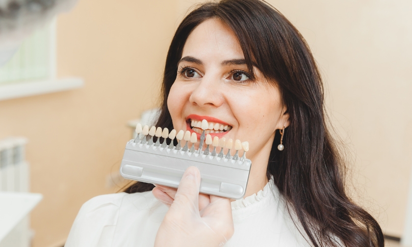 Can Veneers Fix Stains That Don’t Respond to Teeth Whitening in Sugar Land?