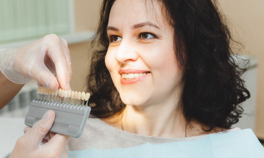 How Do Minimal Prep Veneers Save Your Natural Tooth Structure?