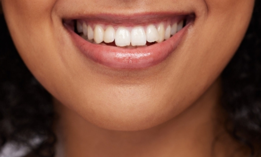 Can a Smile Makeover Make You Look Younger? The Anti-Aging Secrets