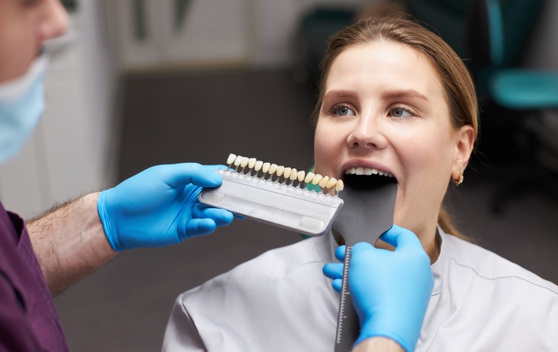 Chicago Guide to Porcelain Veneers From Consultation to Your Dazzling New Smile