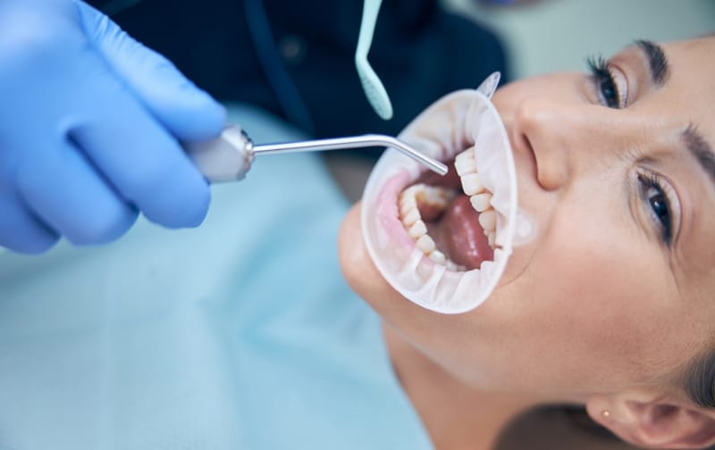 Full Mouth Reconstruction in Chicago Reclaiming Your Smile and Oral Health