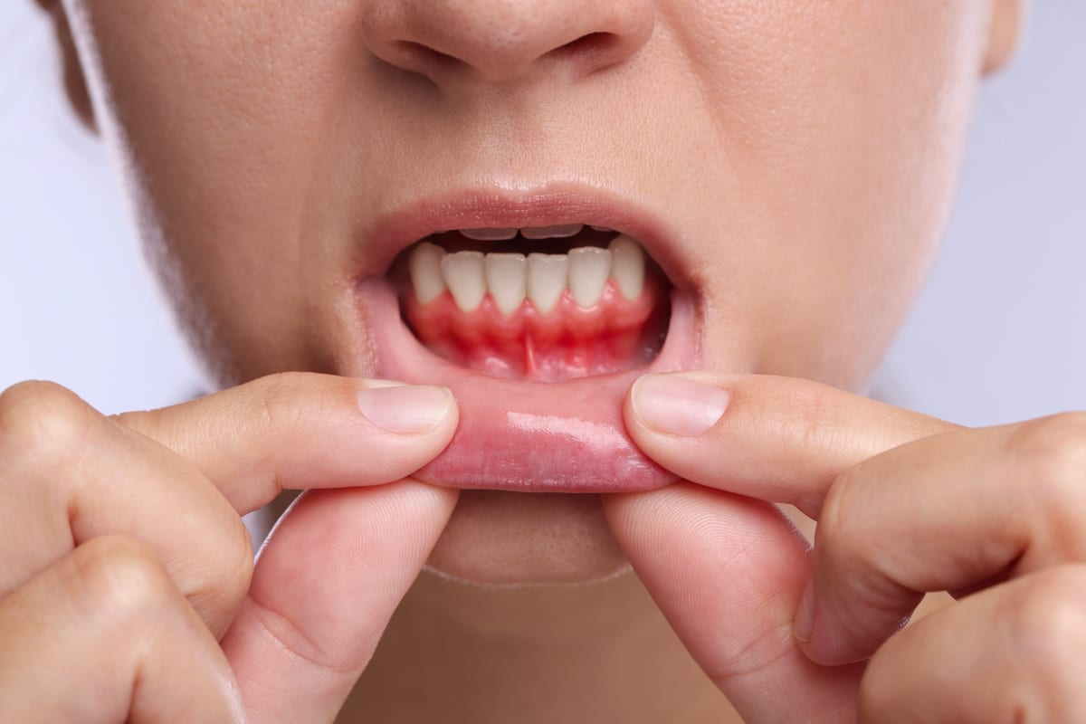 Periodontal Care in Chicago