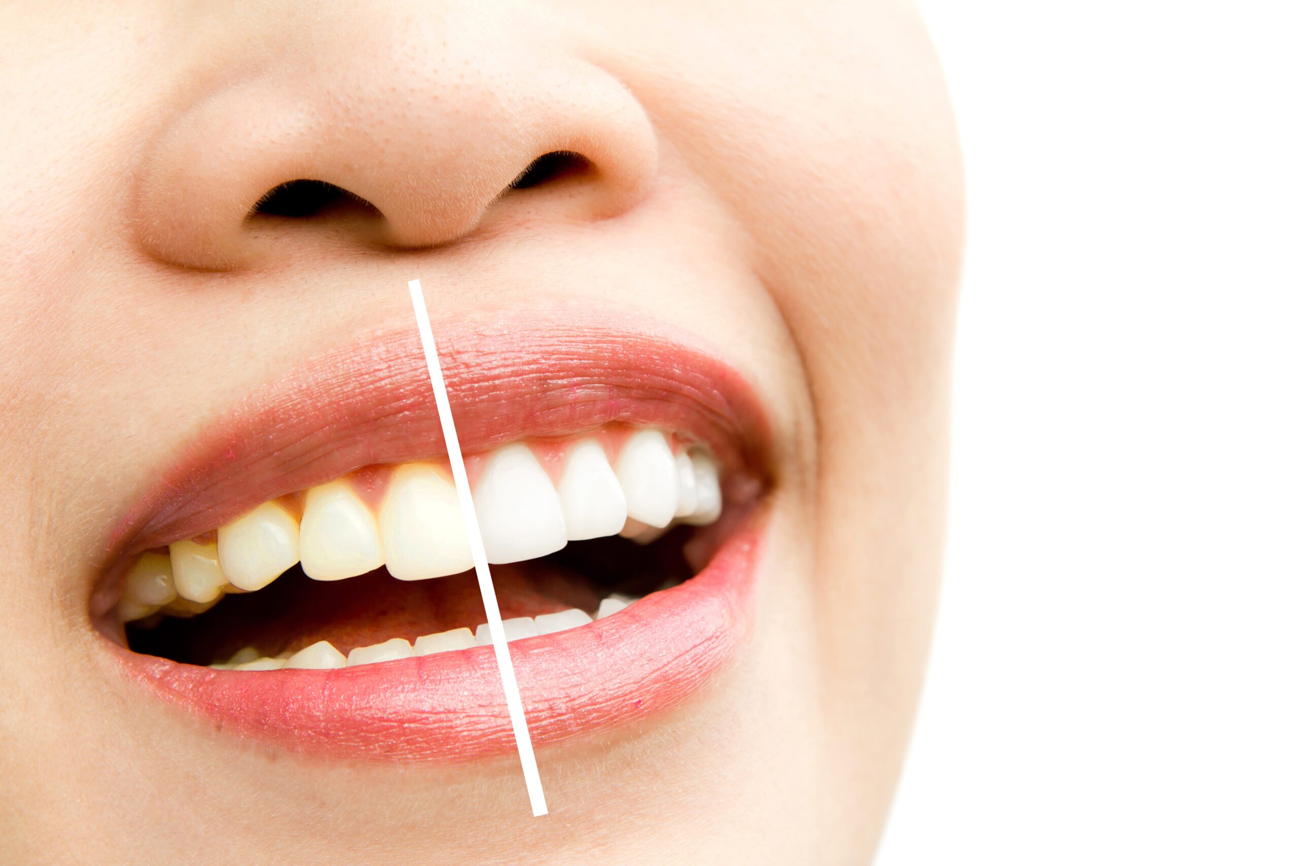 Treatment for gum disease