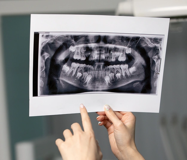 Digital X-rays