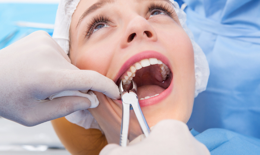 Preparing For Wisdom Tooth Removal Surgery - Wisdom tooth Extraction in Peabody - Miel Dental Peabody Aesthetics
