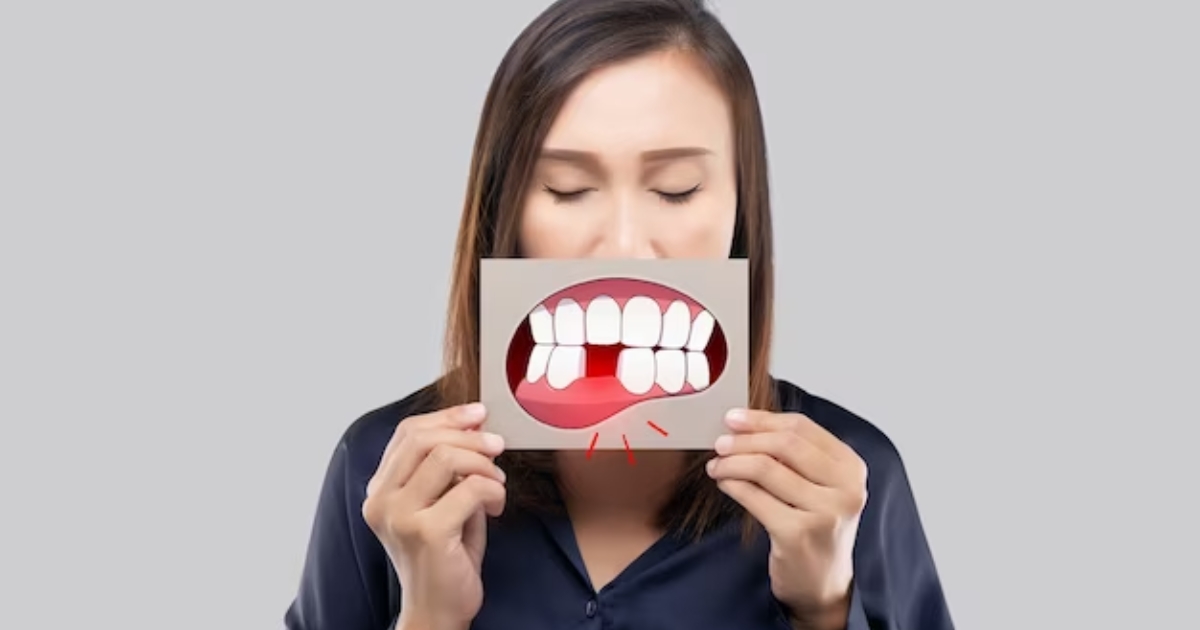 The Importance of Early Detection and Treatment for Cracked Teeth - Miel Dental Aesthetics Peabody