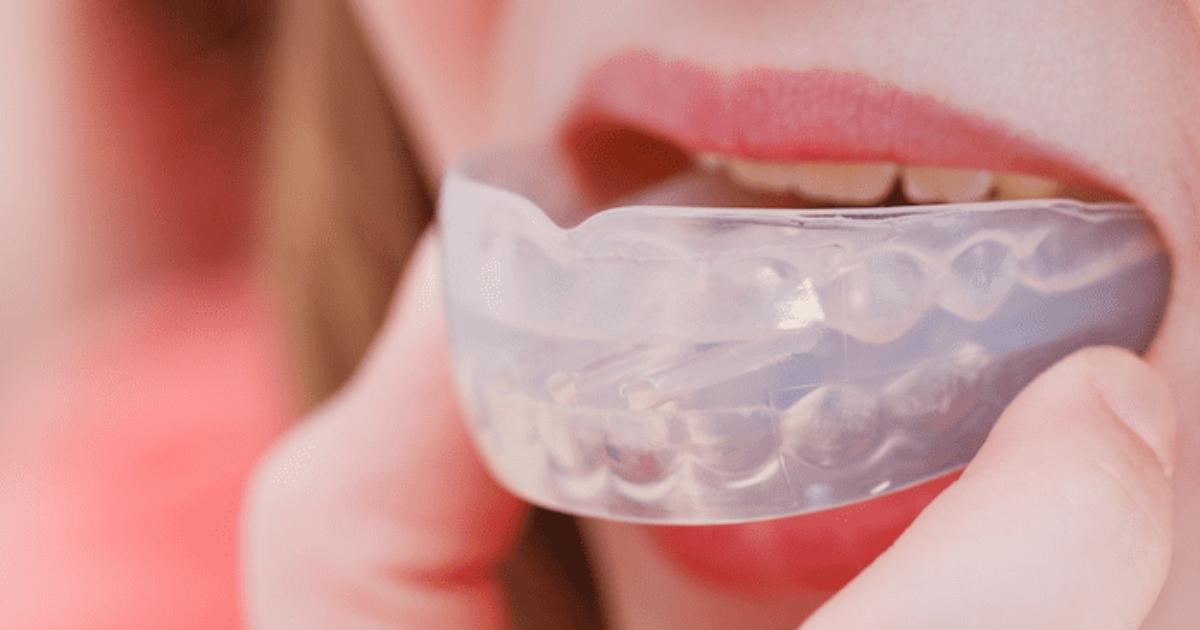 Unveiling the Nightguard Solution Easing the Link Between Stress and Teeth Grinding - Miel Dental Aesthetics Peabody - Dentist Peabody