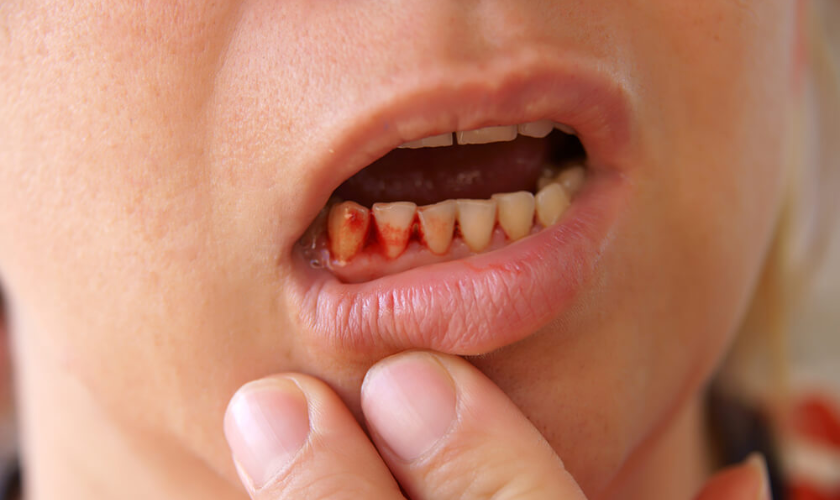 How Gum Disease Can Affect Your Heart