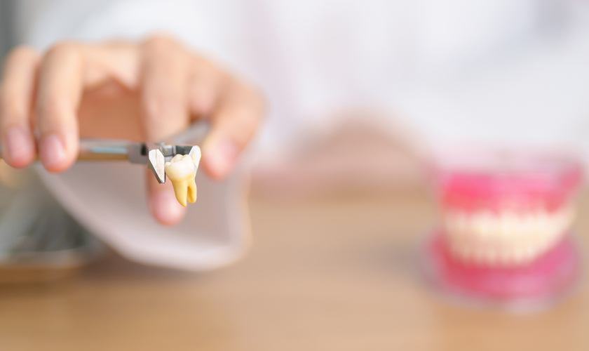 A Guide to Speedy Recovery from Tooth Extraction