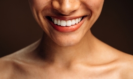how diet affects teeth staining and whitening