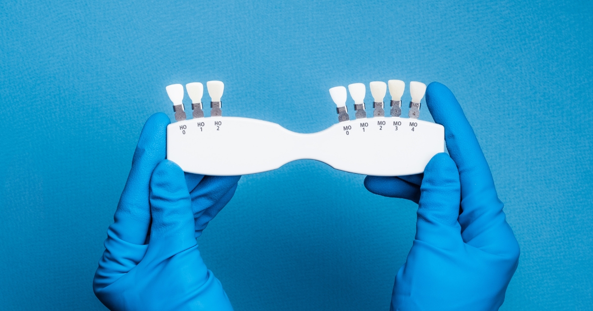 the benefits of choosing dental bridges for missing teeth