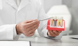 common mistakes people make after getting dental implant