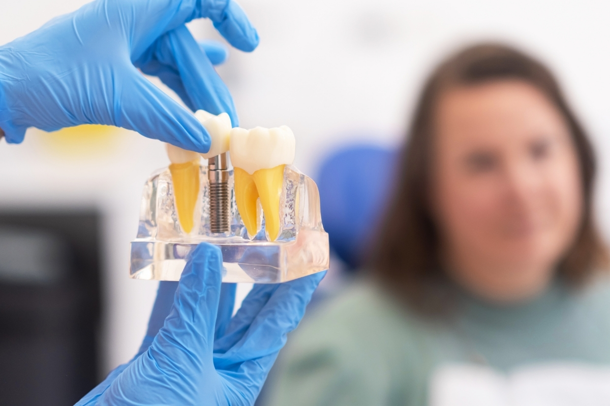 Dental Implant Repair Peabody