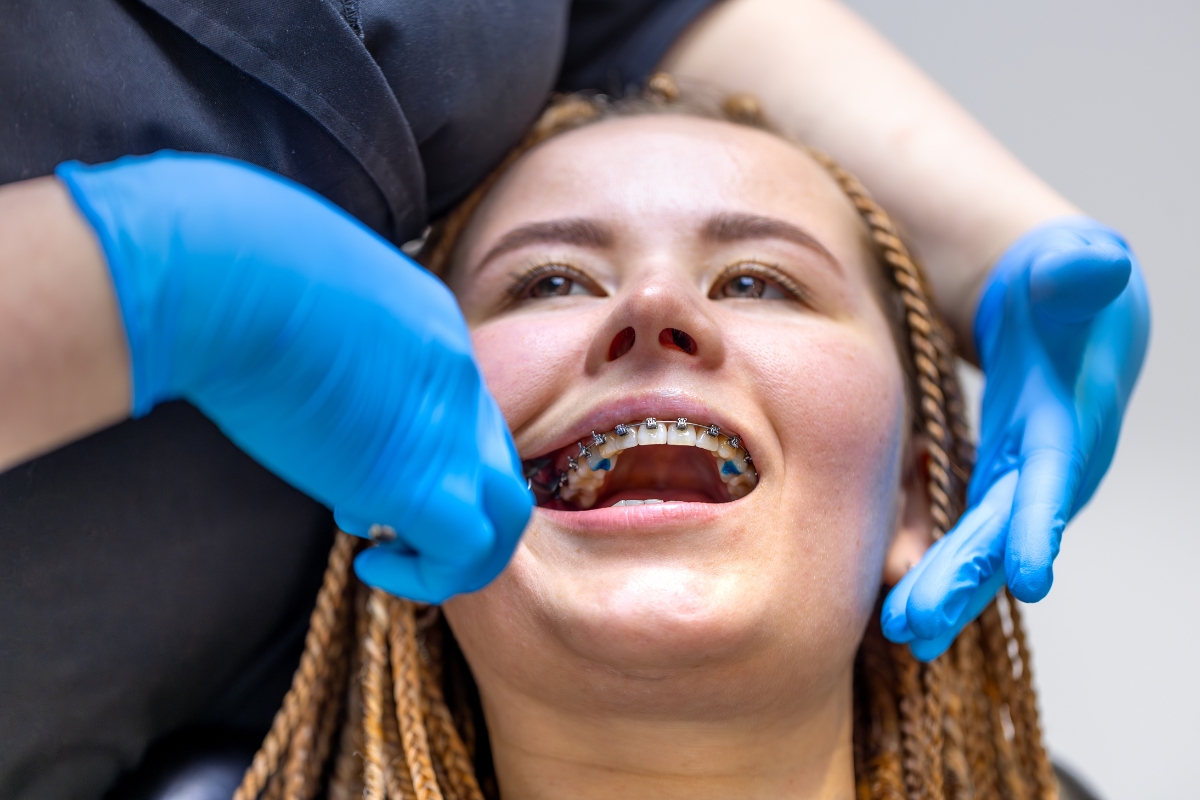 Cosmetic Dentist Peabody