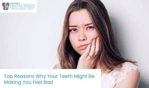 Bad Teeth