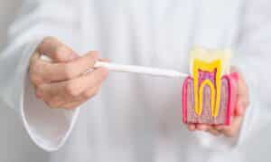 5 things diabetic patients should know before root canal treatment