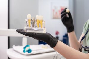 Dental Crowns in Boynton Beach