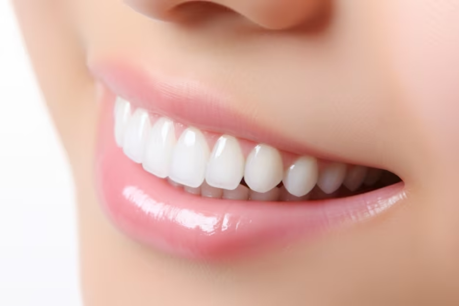 Coffee Stains Got You Down? 7 Surprisingly Effective Teeth-Whitening Hacks