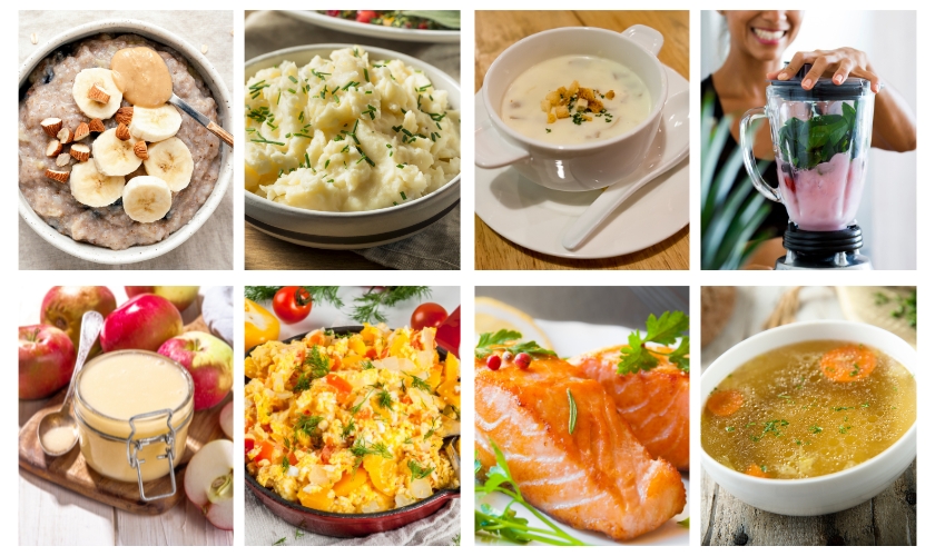 Foods to Avoid After Dental Implant Surgery: Tips for Better Healing