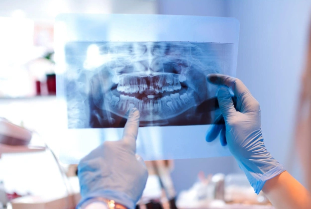 digital dental x-ray in brooklyn heights