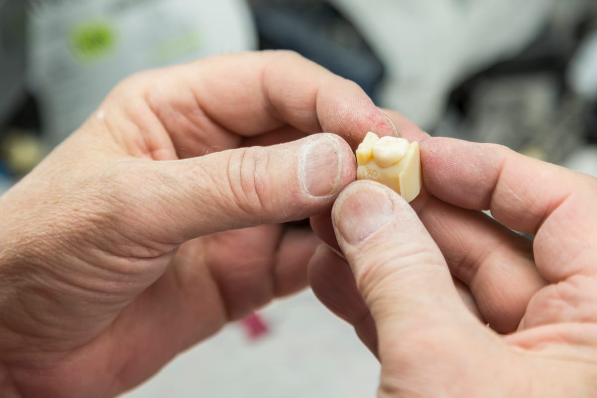 Dental Crowns in Brownsville