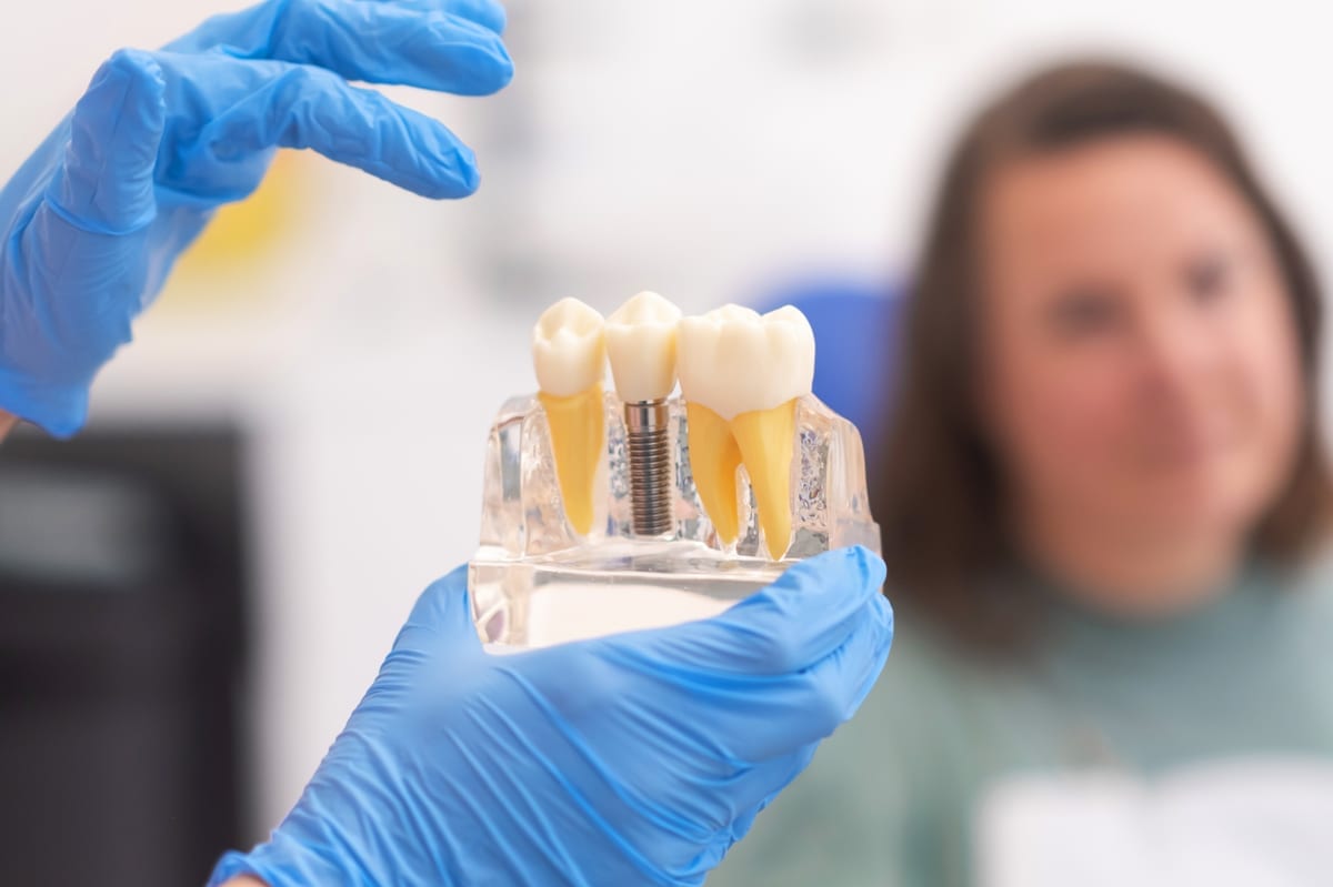 Dental Implants in Brooklyn