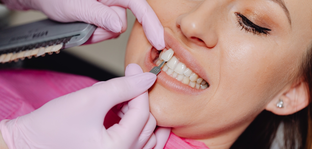 5 Common Cosmetic Dental Flaws & How They’re Addressed