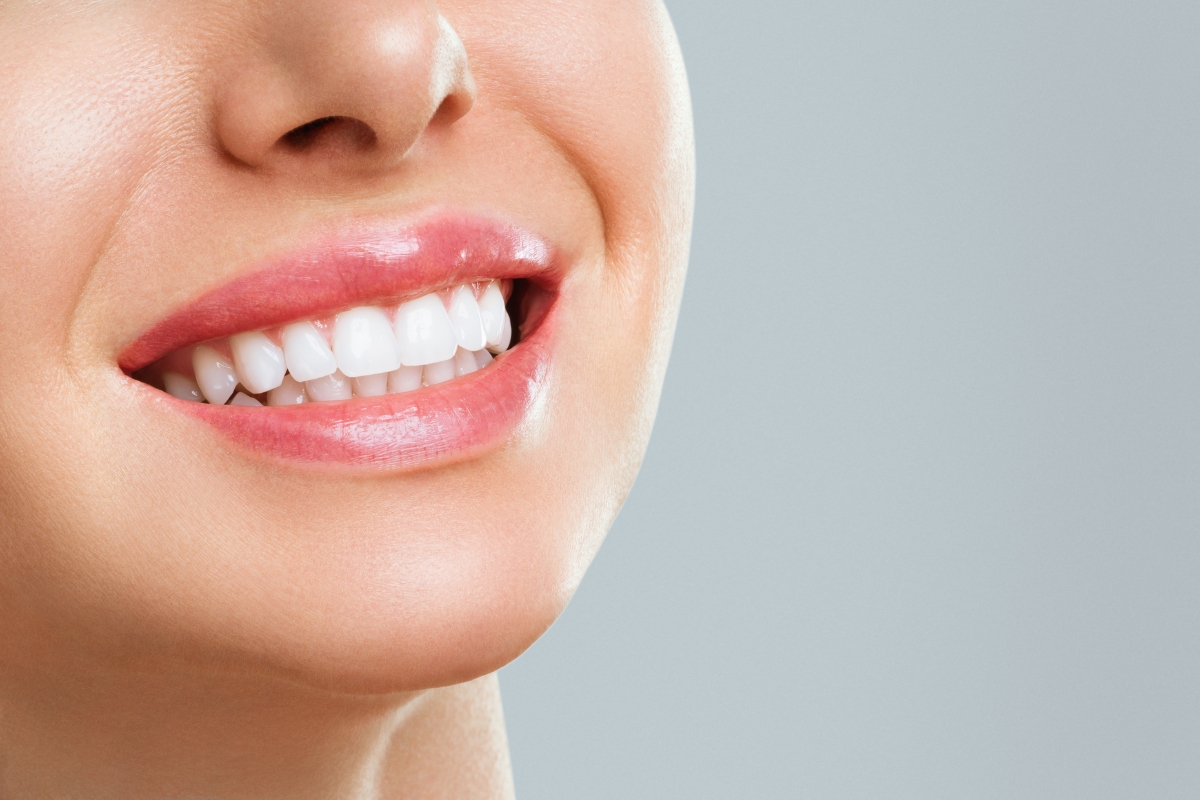 teeth-whitening-in-Los-Alamitos