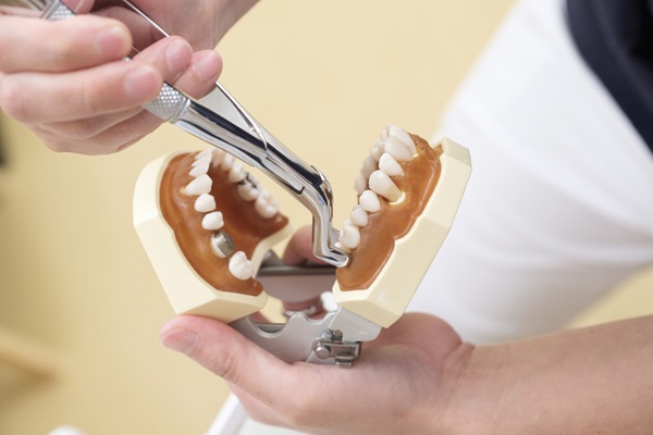 Why Wisdom Tooth Extraction Is Common in Young Adults: A Guide for Families