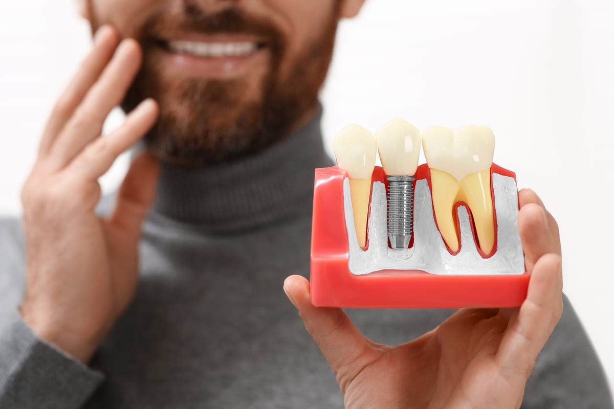 Dental Implants in High Point