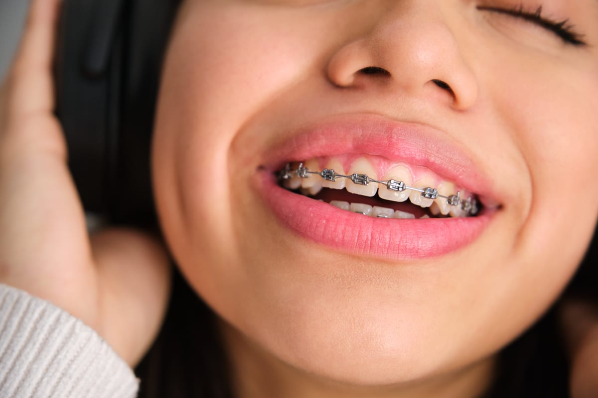 Orthodontics in Spring Hill
