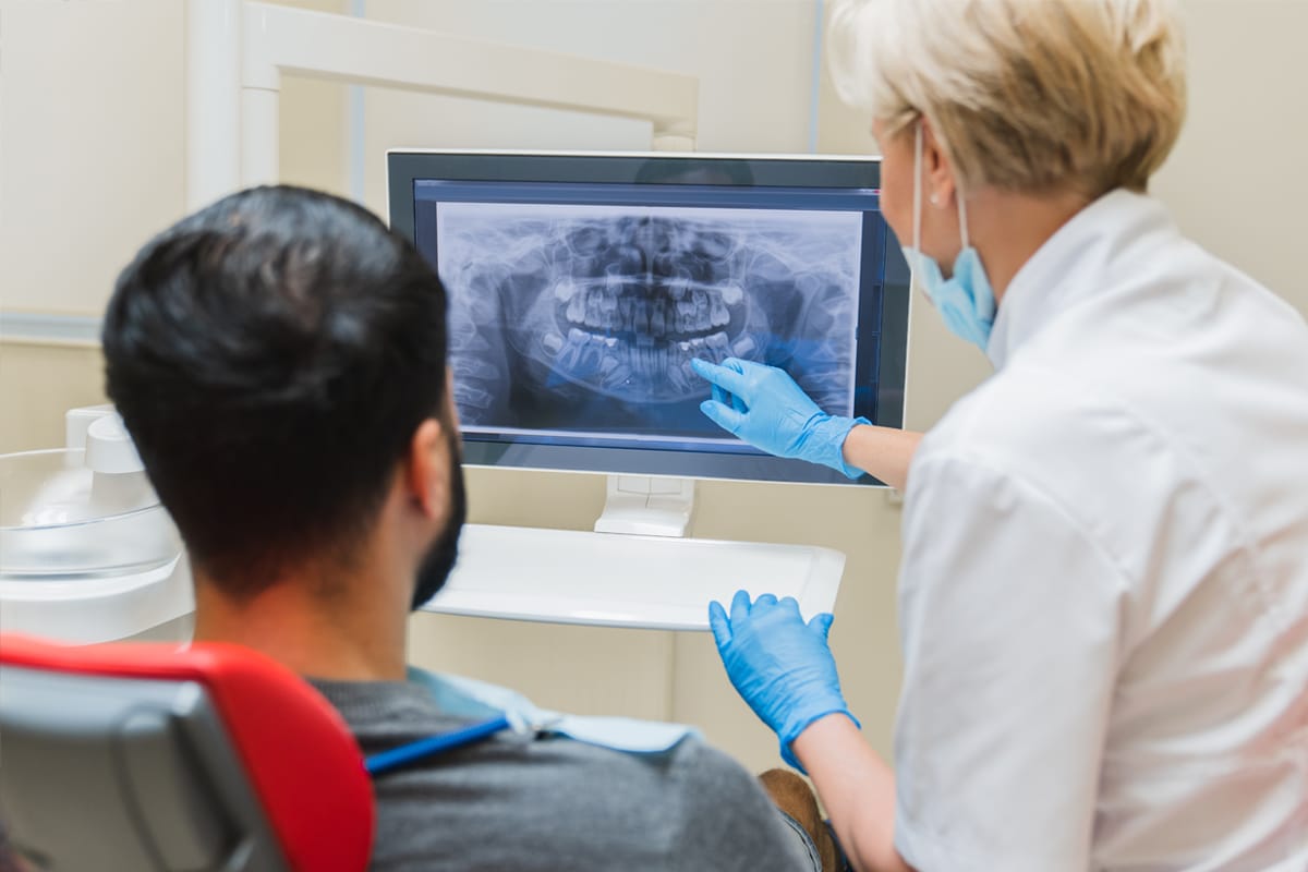 Implants: The Most Natural Teeth Replacement on the Market
