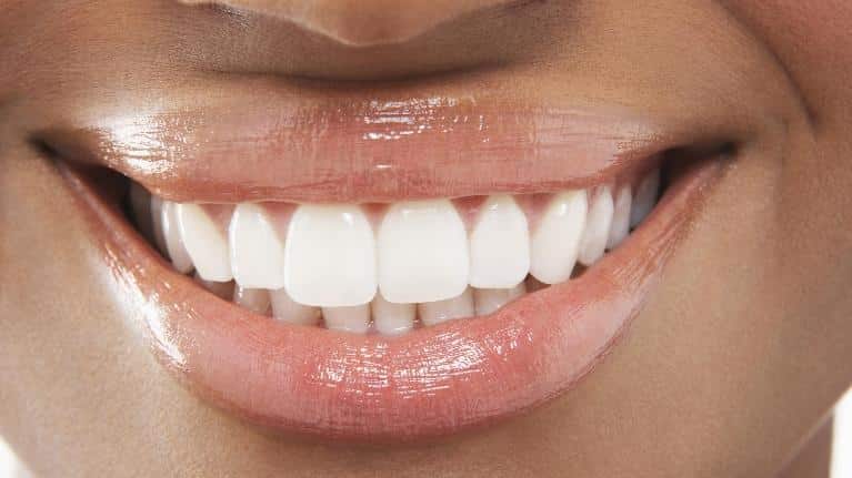 3 Benefits of Laser Gum Treatments over Traditional Gum Surgery