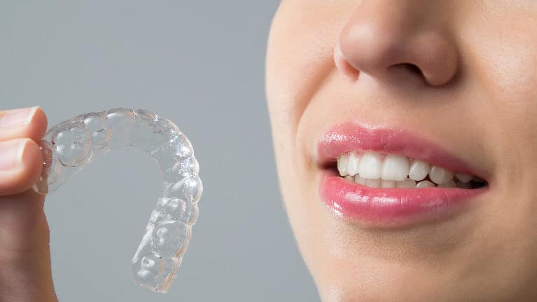 Considering Invisalign? Here’s What You Can Plan For