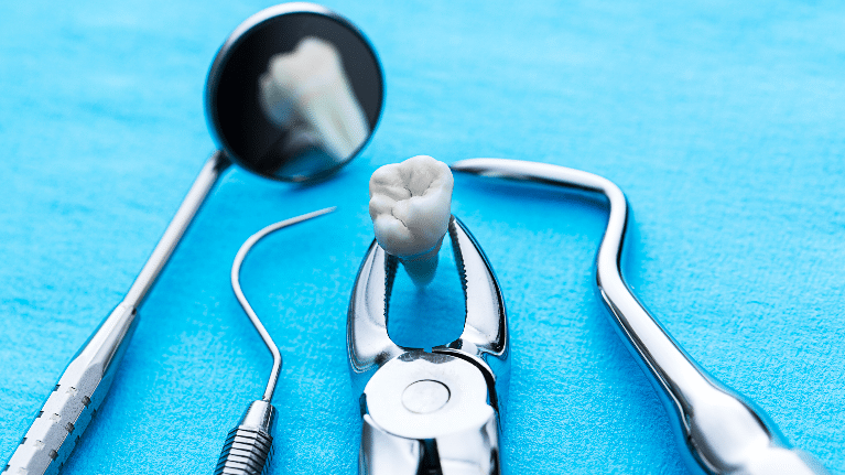 Situations That Require Dental Extractions
